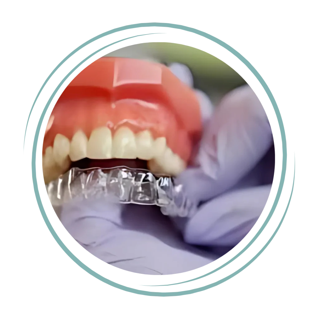 Invisalign and Clear Aligner Treatment