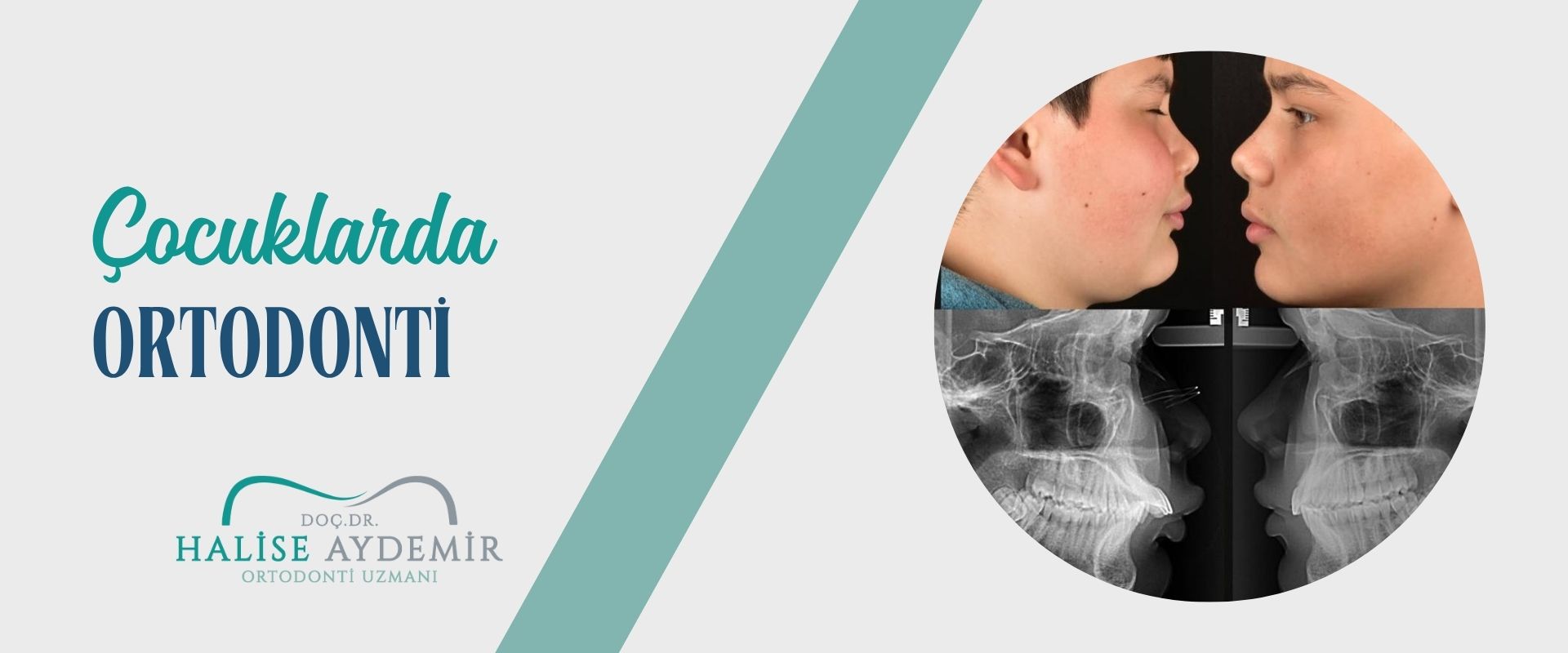 Dr. Halise Aydemir kliniğinden görünüm
