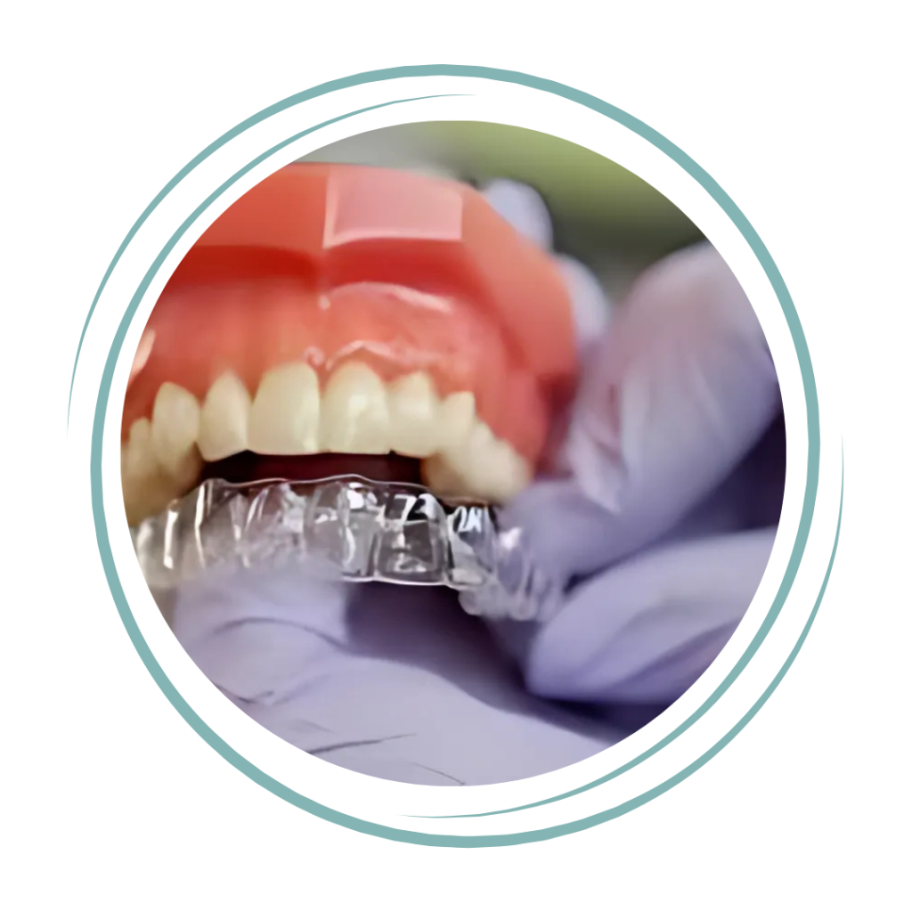 Invisalign ve şeffaf plak tedavisi
